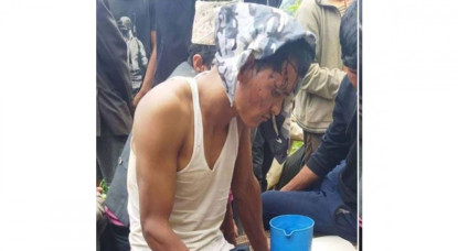 बारेकोट गाउँपालिका-६ का अध्यक्षमाथि खुकरी प्रहार